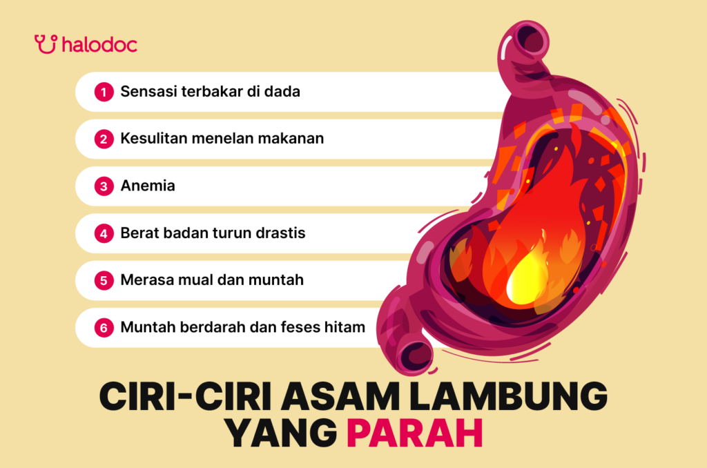 Gejala Asam Lambung Naik Penyebab, Ciri-Ciri, dan Cara Mengatasinya Secara Alami