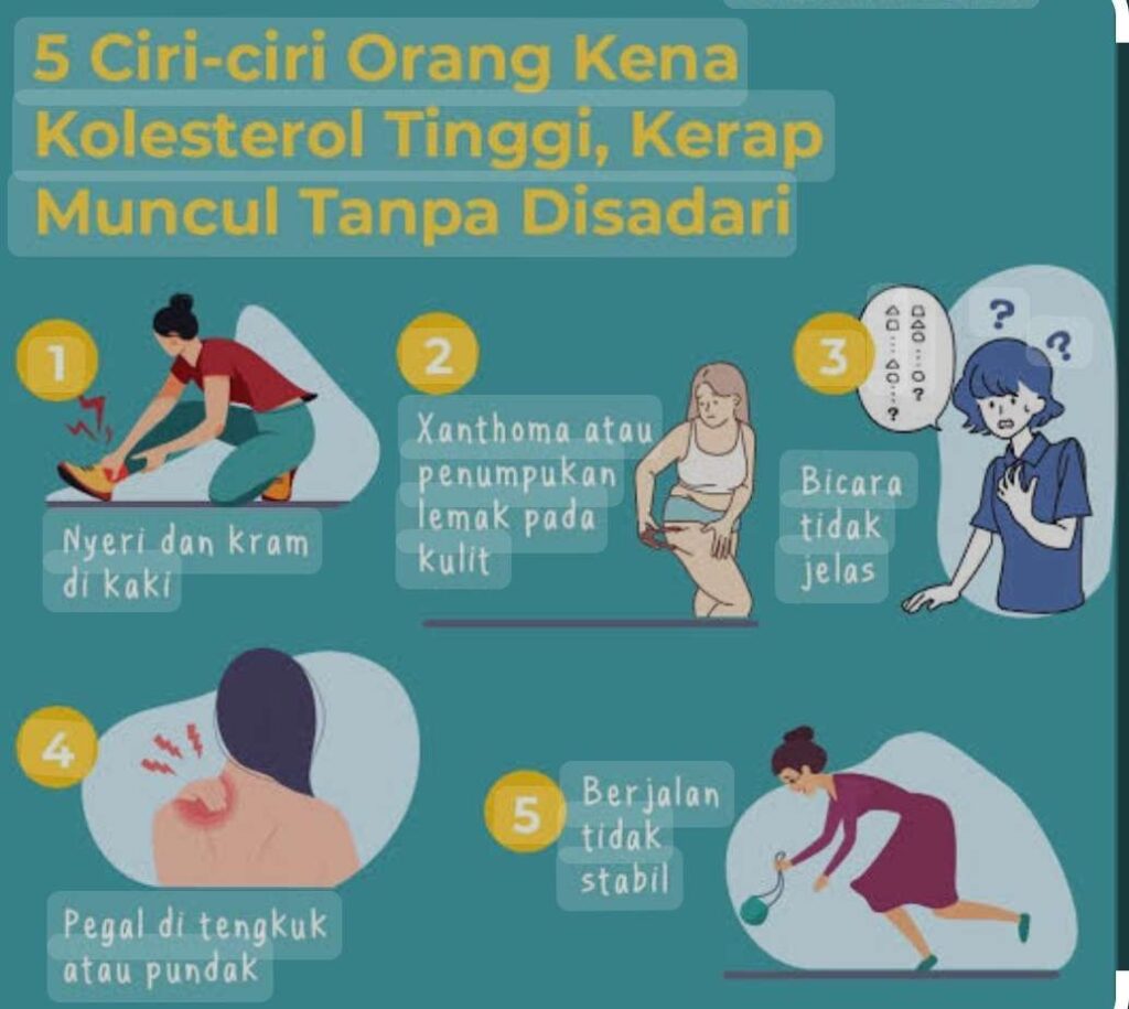 Ciri-Ciri Kolesterol Tinggi dan Cara Mengatasinya Secara Aman